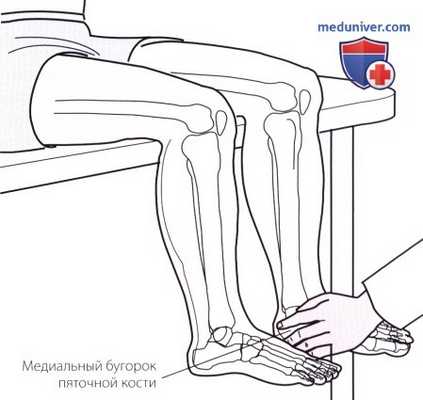 Пальпация стопы со стороны подошвы (подошвенной поверхности)