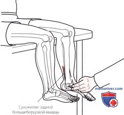 Пальпация голеностопного сустава и стопы с внутренней стороны (медиальной)