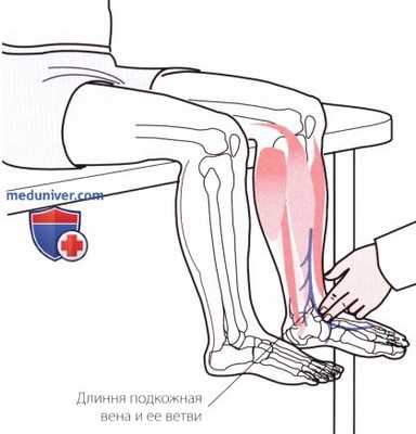 Пальпация голеностопного сустава и стопы с внутренней стороны (медиальной)