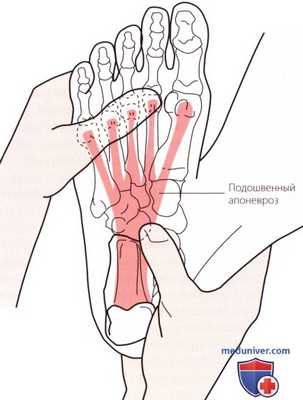 Пальпация стопы со стороны подошвы (подошвенной поверхности)