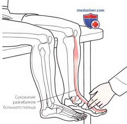 Пальпация голеностопного сустава и стопы с тыльной стороны