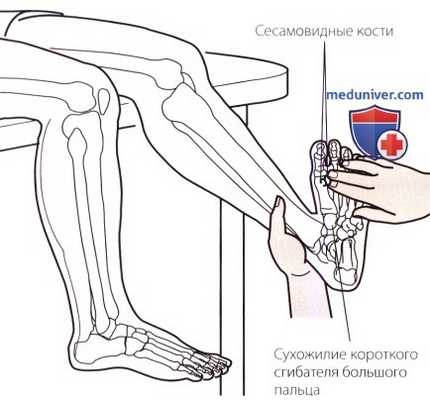 Пальпация стопы со стороны подошвы (подошвенной поверхности)