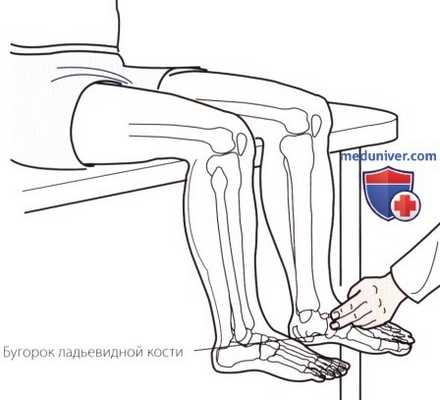 Пальпация голеностопного сустава и стопы с внутренней стороны (медиальной)