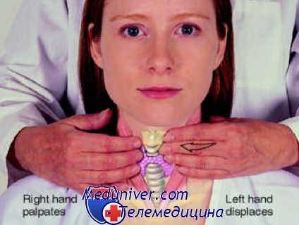 пальпация щитовидной железы