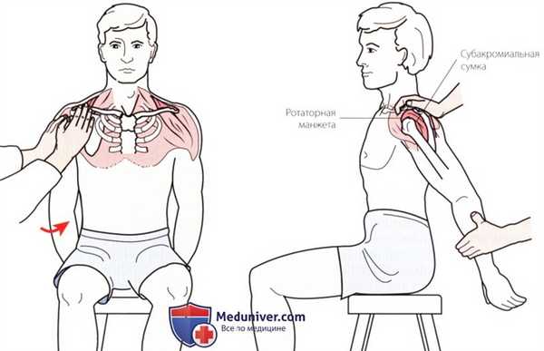 Пальпация плечевого сустава с латеральной стороны