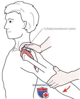 Пальпация плечевого сустава с латеральной стороны