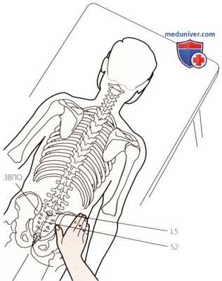 Пальпация костей пояснично-крестцового отдела позвоночника сзади