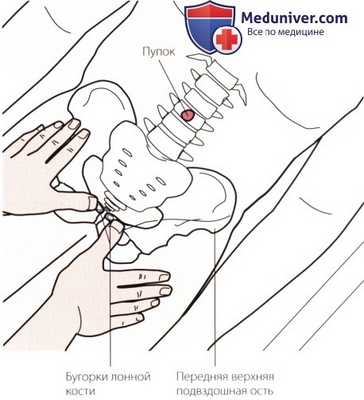 Пальпация пояснично-крестцового отдела позвоночника спереди