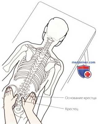 Пальпация костей пояснично-крестцового отдела позвоночника сзади