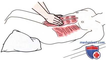 Пальпация пояснично-крестцового отдела позвоночника спереди