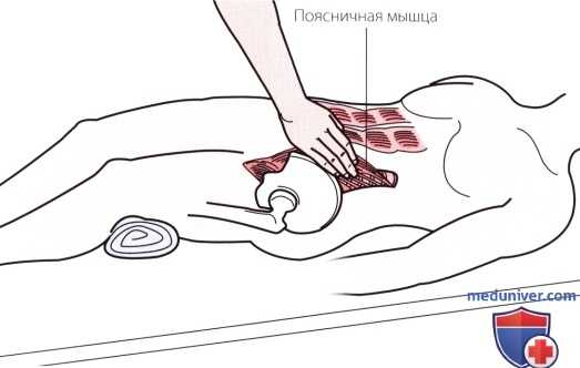 Пальпация пояснично-крестцового отдела позвоночника спереди