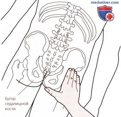 Пальпация костей пояснично-крестцового отдела позвоночника сзади