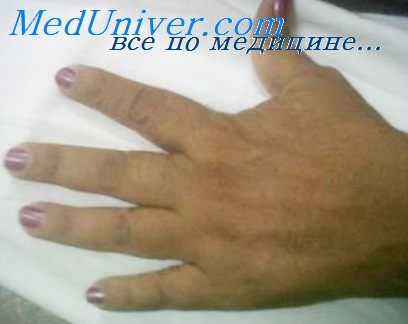 связки пациента