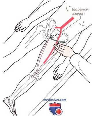 Пальпация тазобедренного сустава спереди