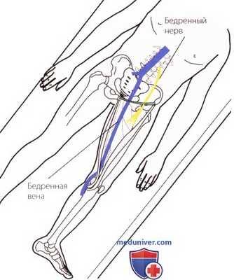 Пальпация тазобедренного сустава спереди