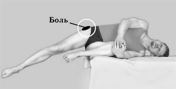 Боль в тазобедренном суставе