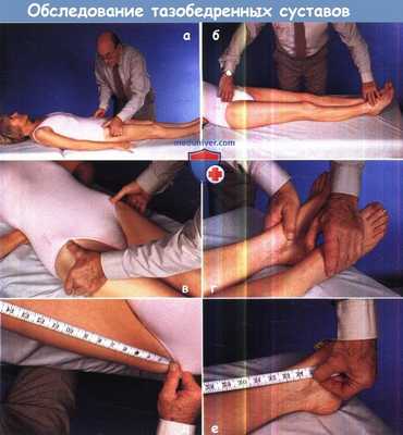 Обследование тазобедренных суставов