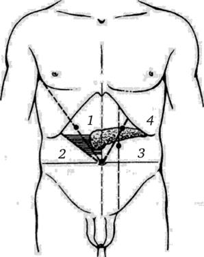 Проекция болевых точек на переднюю брюшную стенку