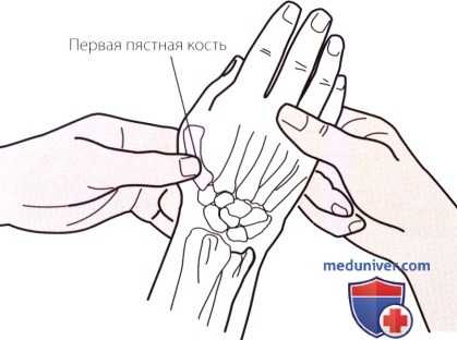 Пальпация запястья и кисти с латеральной (лучевой) стороны