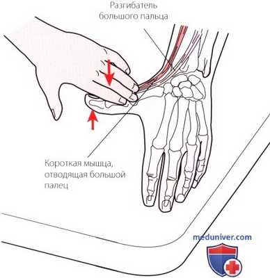 Пальпация запястья и кисти сзади (тыла)