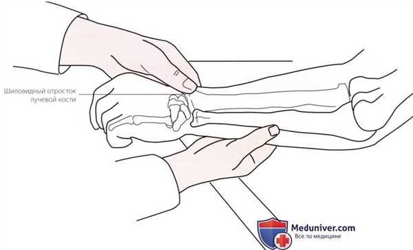 Пальпация запястья и кисти с латеральной (лучевой) стороны