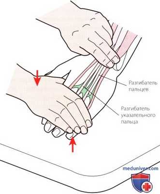 Пальпация запястья и кисти сзади (тыла)