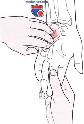 Пальпация запястья и кисти спереди (ладони)