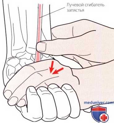 Пальпация запястья и кисти спереди (ладони)