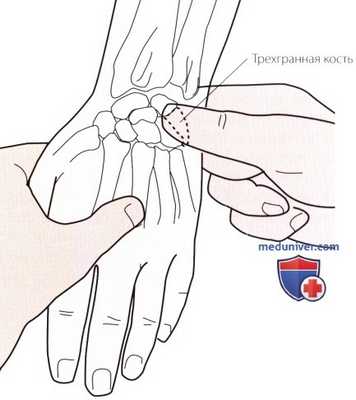 Пальпация запястья и кисти с медиальной (локтевой) стороны