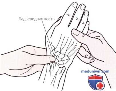 Пальпация запястья и кисти с латеральной (лучевой) стороны