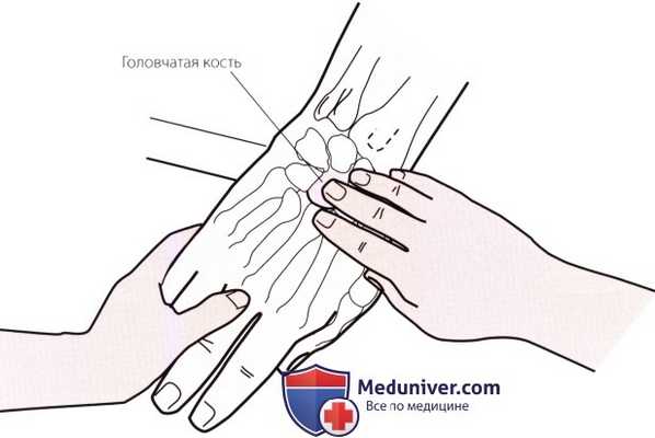 Пальпация запястья и кисти сзади (тыла)