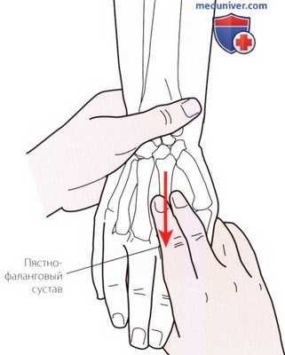 Пальпация запястья и кисти сзади (тыла)