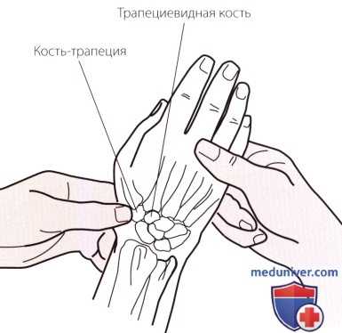Пальпация запястья и кисти с латеральной (лучевой) стороны
