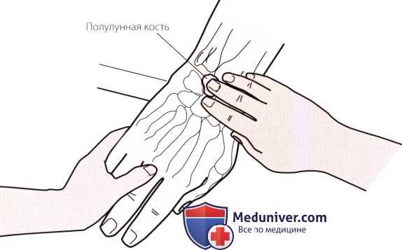 Пальпация запястья и кисти сзади (тыла)