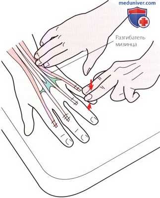 Пальпация запястья и кисти сзади (тыла)