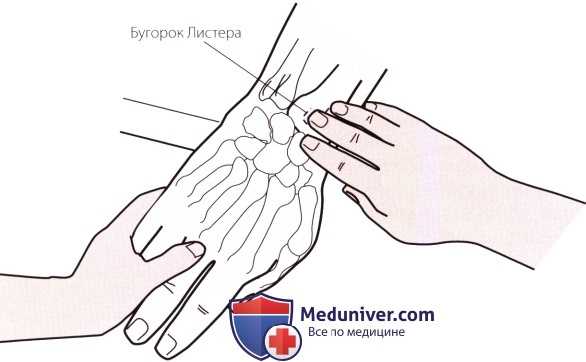 Пальпация запястья и кисти сзади (тыла)