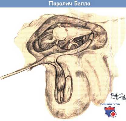 Анатомия паралича Белла