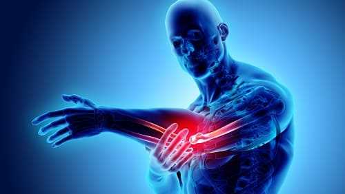 Концепт мужчина с переломом локтя