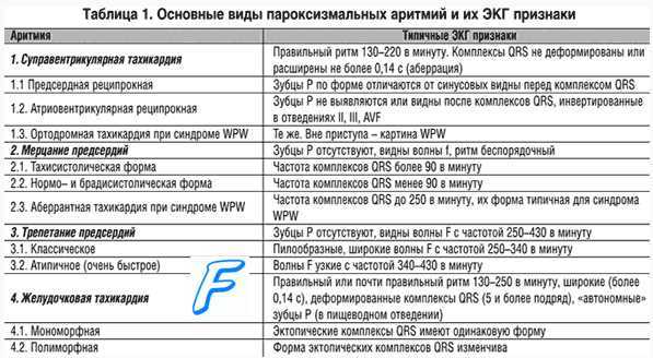 Пароксизмальная суправентрикулярная тахикардия при инфаркте миокарда ( оим, ОИМ ).