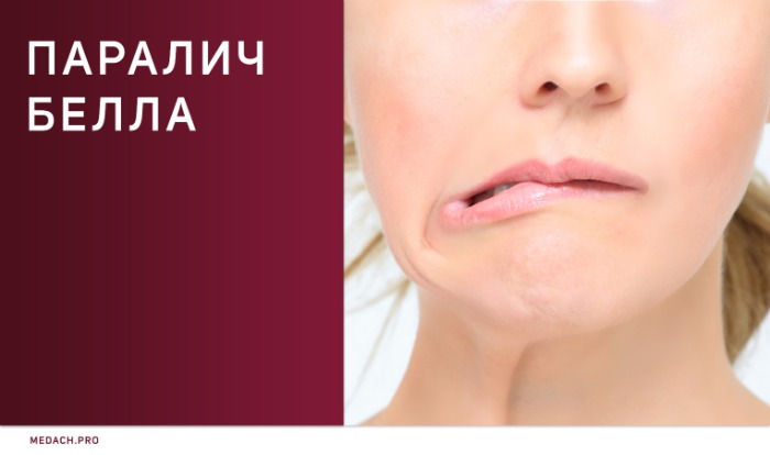 Чарльз Белл