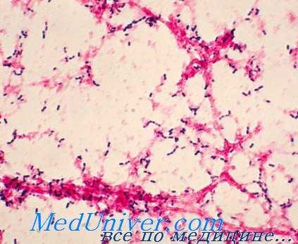 пневмококковая инфекция