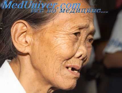 патогенез сапа