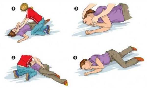 Первая помощь при фебрильном приступе