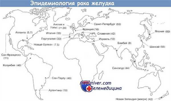 Эпидемиология рака желудка