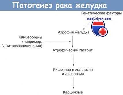 Патогенез рака желудка