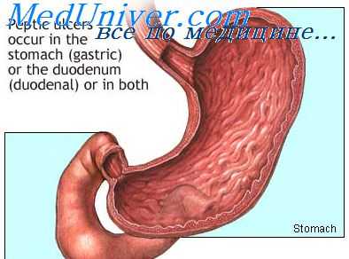 опухоли желудка