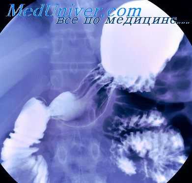 болезни желудка