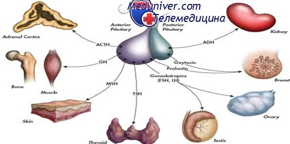 гипопитуитаризм