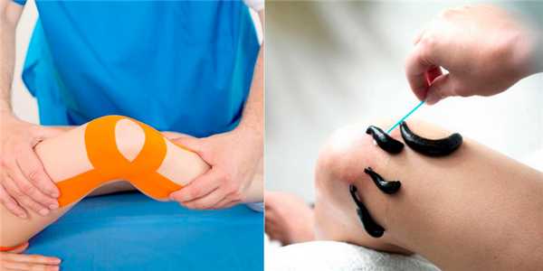 Немедикаментозные способы лечения