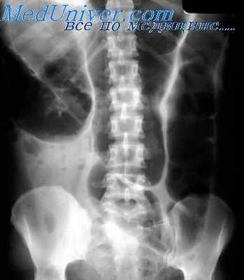 патология пищеварительного тракта